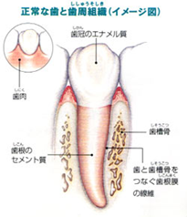 歯周外科とは